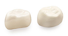 NuSmile® BioFlx crown